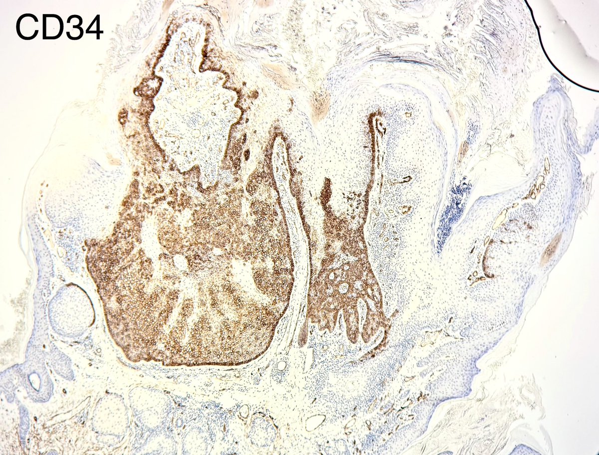 Francesco Fortarezza tweet media