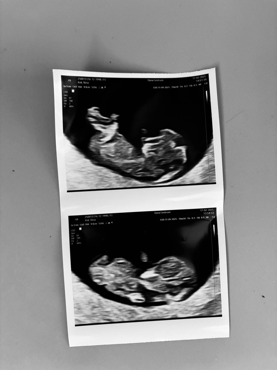 Stijn Van Eeckhoutte tweet media