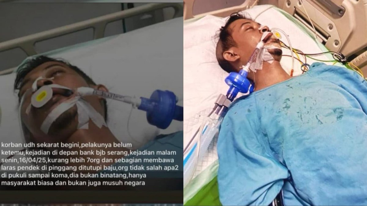 Heraloebss's tweet photo. OKNUM TNI BIADAB

Seorang Pemuda Sipil Tewas Diduga Dianiaya Oknum TNI , seluruh wajahnya babak belur. (16/4/2025)
📍Kota Serang , Banten

Selengkapnya >>>> https://t.co/7GcMKGgPUn