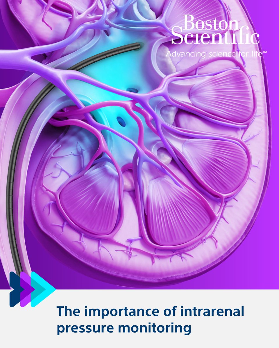 Would you monitor #IntrarenalPressure (IRP) in every patient?

Read the clinical evidence around IRP: bit.ly/4lD8Stj
 
#BSCEMEA #endourology