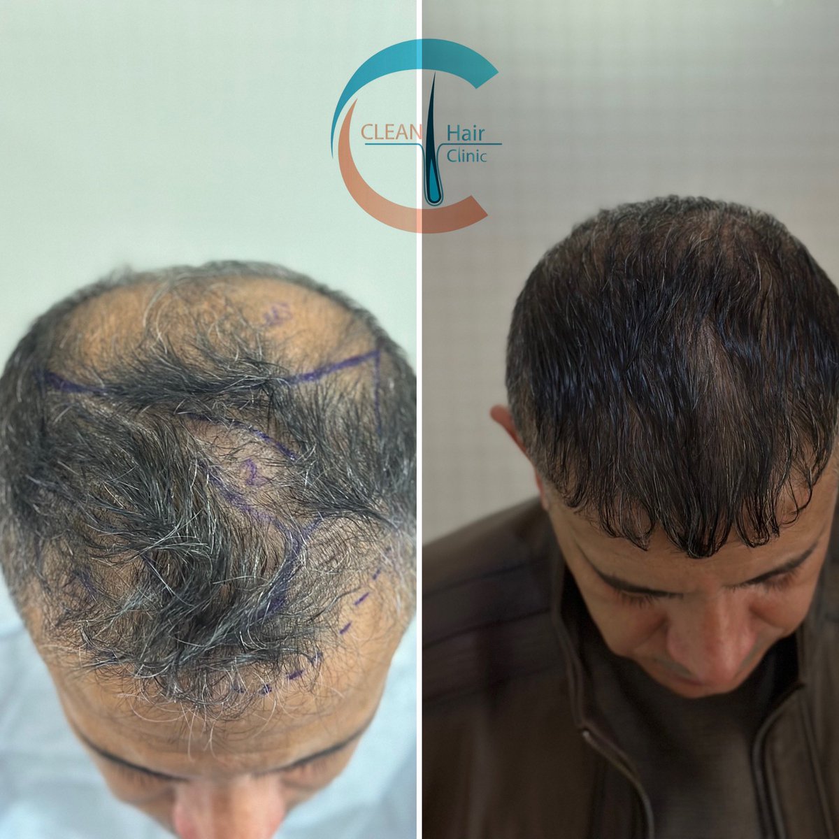hair_clean's tweet photo. https://t.co/sHVVBIp5BB