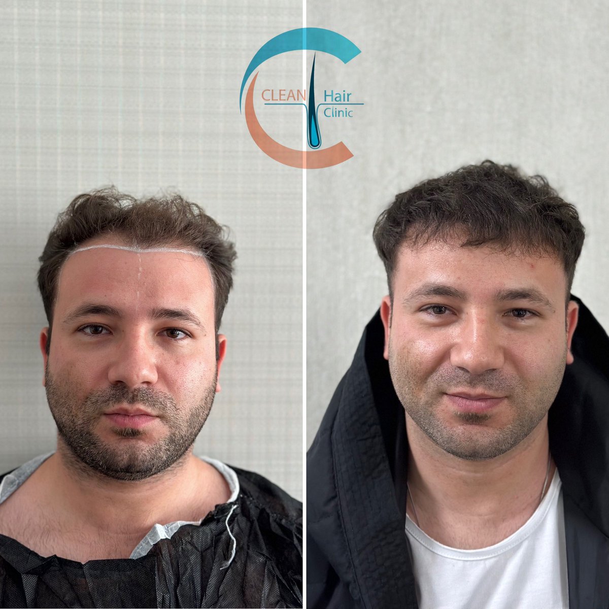 hair_clean's tweet photo. https://t.co/sHVVBIp5BB
