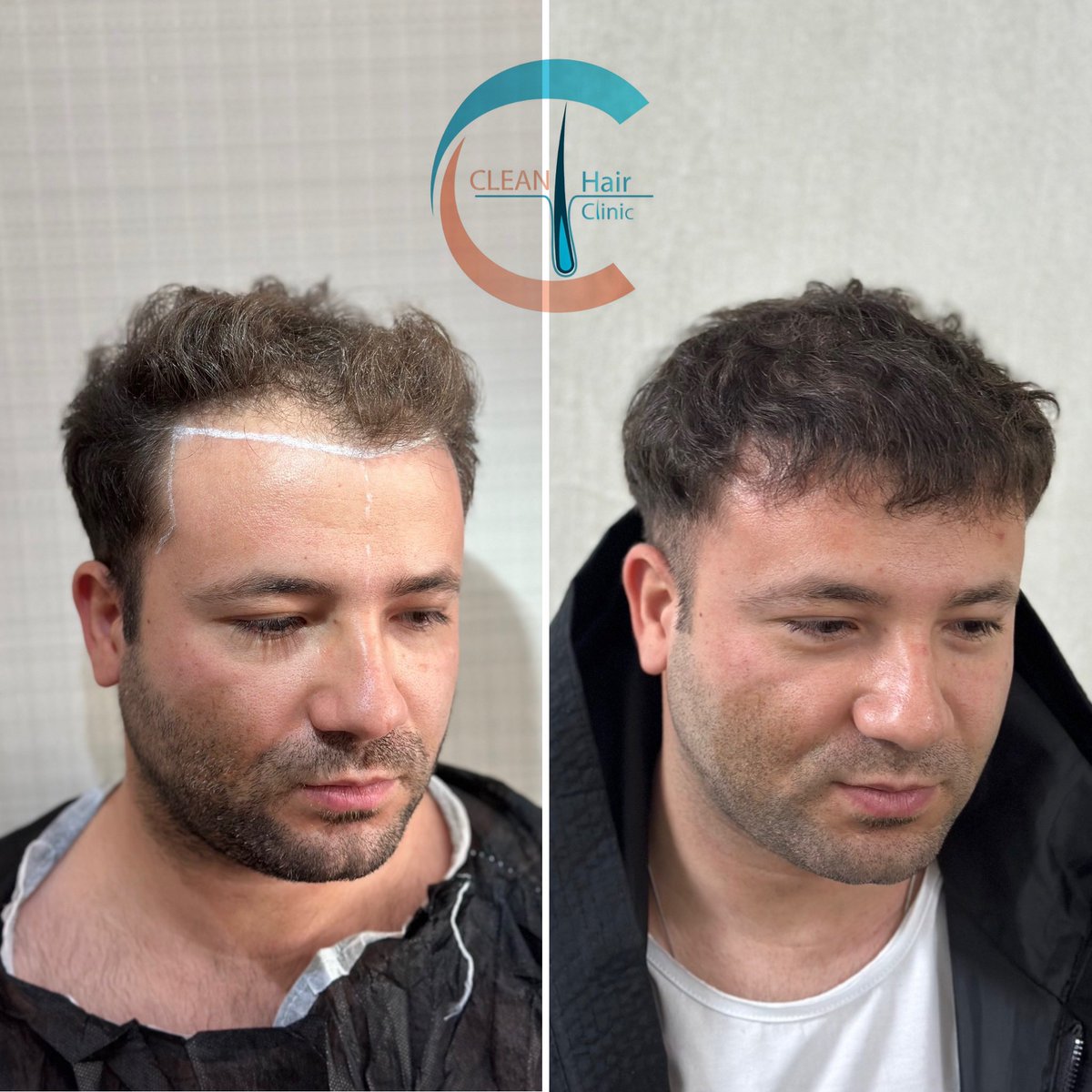 hair_clean's tweet photo. https://t.co/sHVVBIp5BB