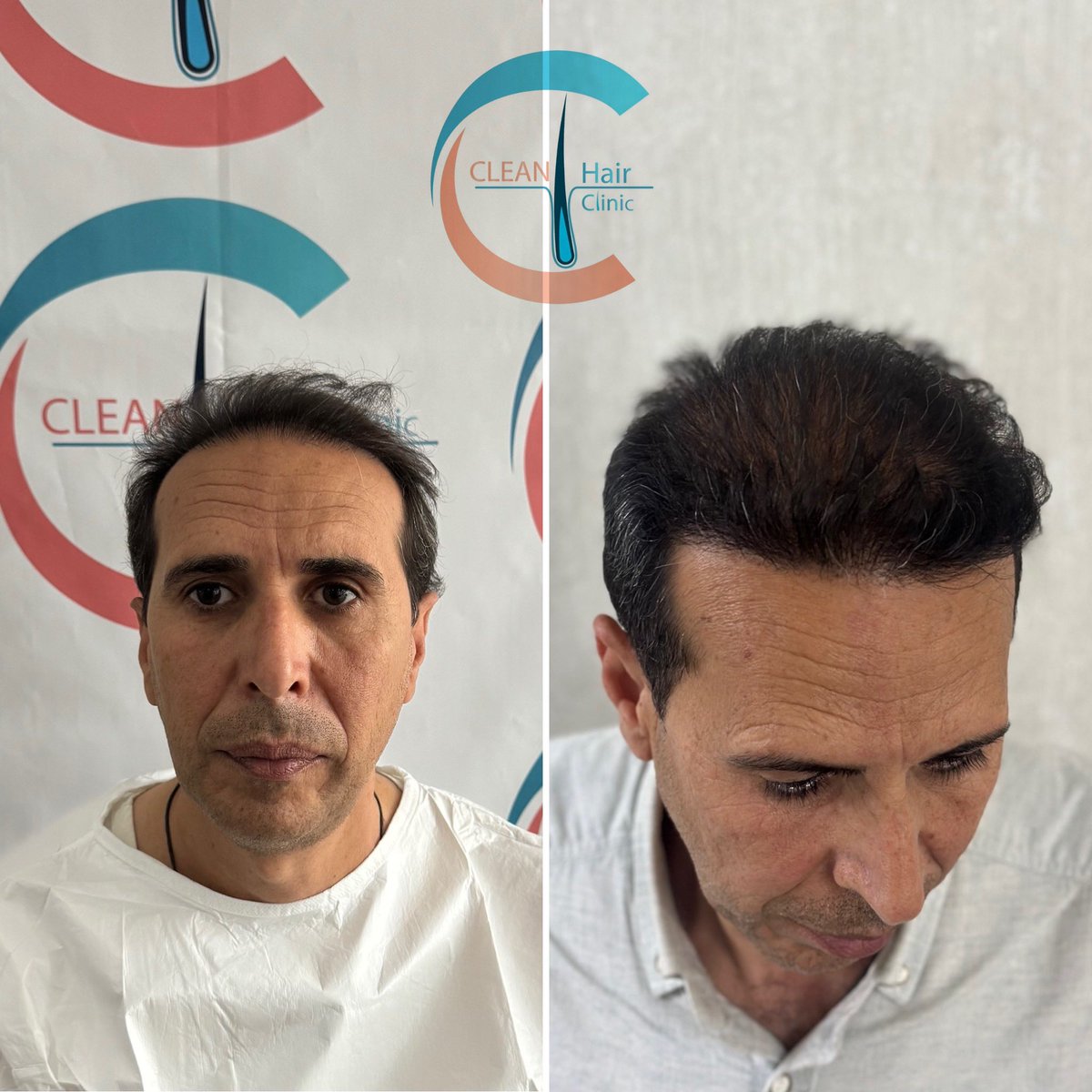 hair_clean's tweet photo. https://t.co/zgTCTdcitv