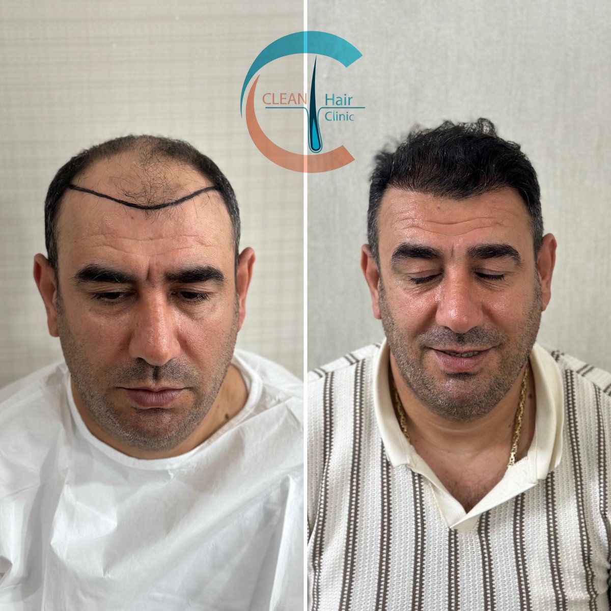 hair_clean's tweet photo. https://t.co/NTLCsinWV9