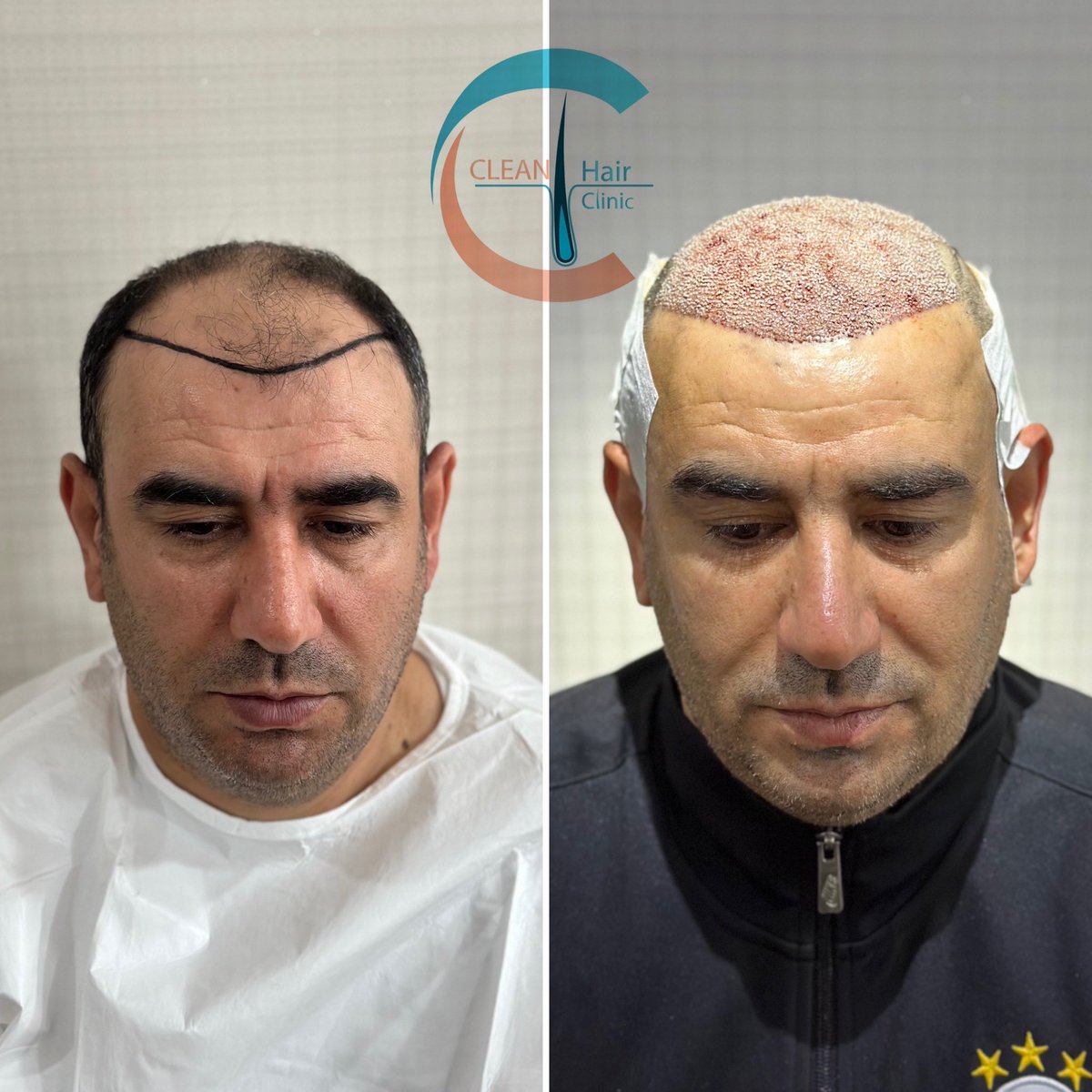 hair_clean's tweet photo. https://t.co/yFt2CtwiX7