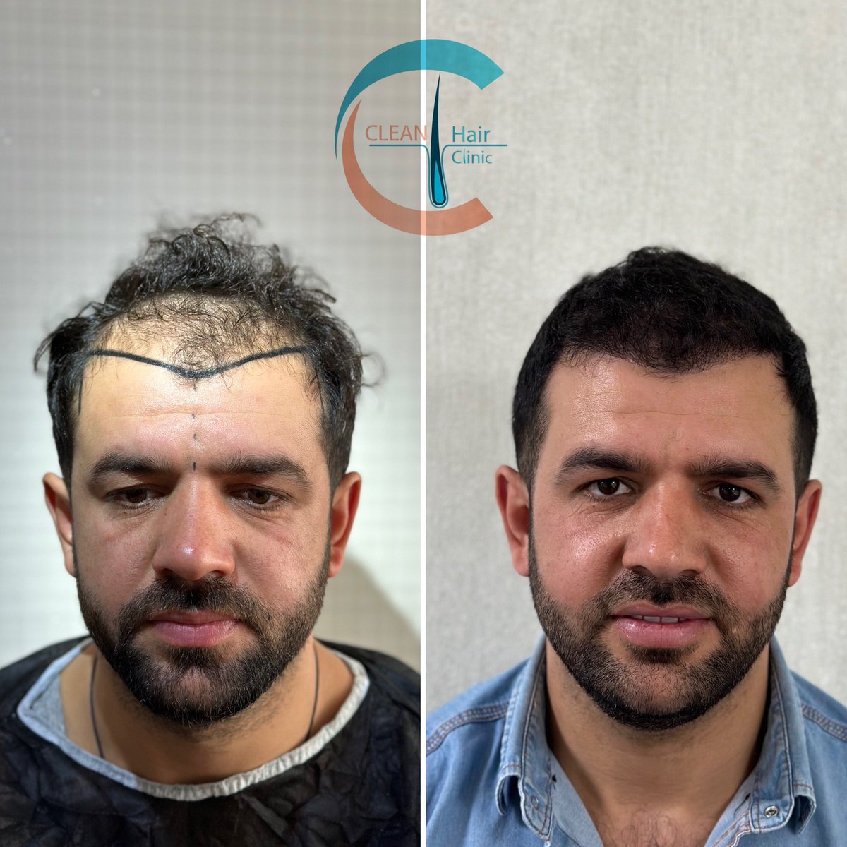 hair_clean's tweet photo. https://t.co/yFt2CtwiX7
