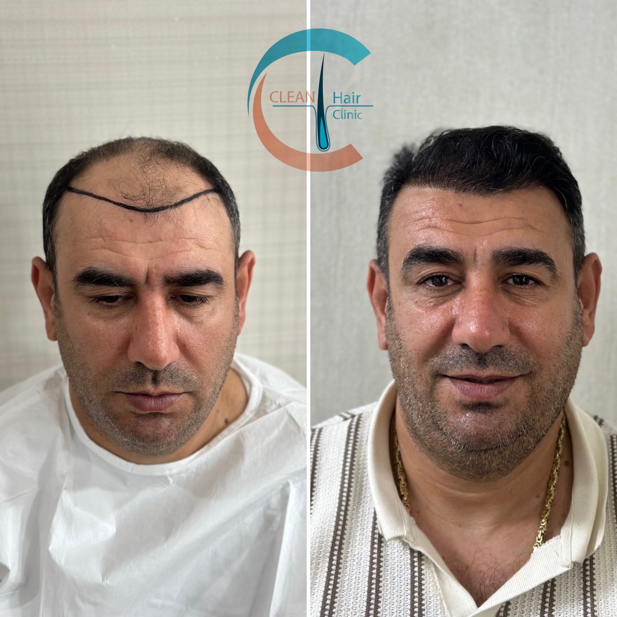 hair_clean's tweet photo. https://t.co/yFt2CtwiX7