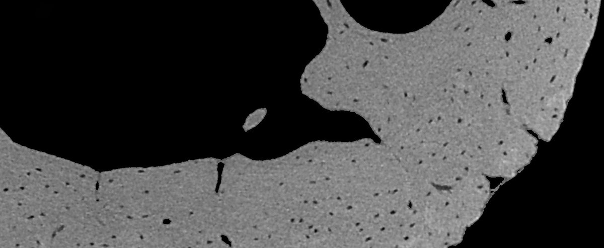 bruker's tweet photo. The X4 POSEIDON system allows for submicron imaging of mouse bone osteocytes, revealing the distribution of osteocyte lacunae and blood vessel canals 🦴: https://t.co/fA9zKEyE8G
#BoneResearch #RodentModels #MicroCT #X4POSEIDON #Innovation https://t.co/lRXa7Gp1mH