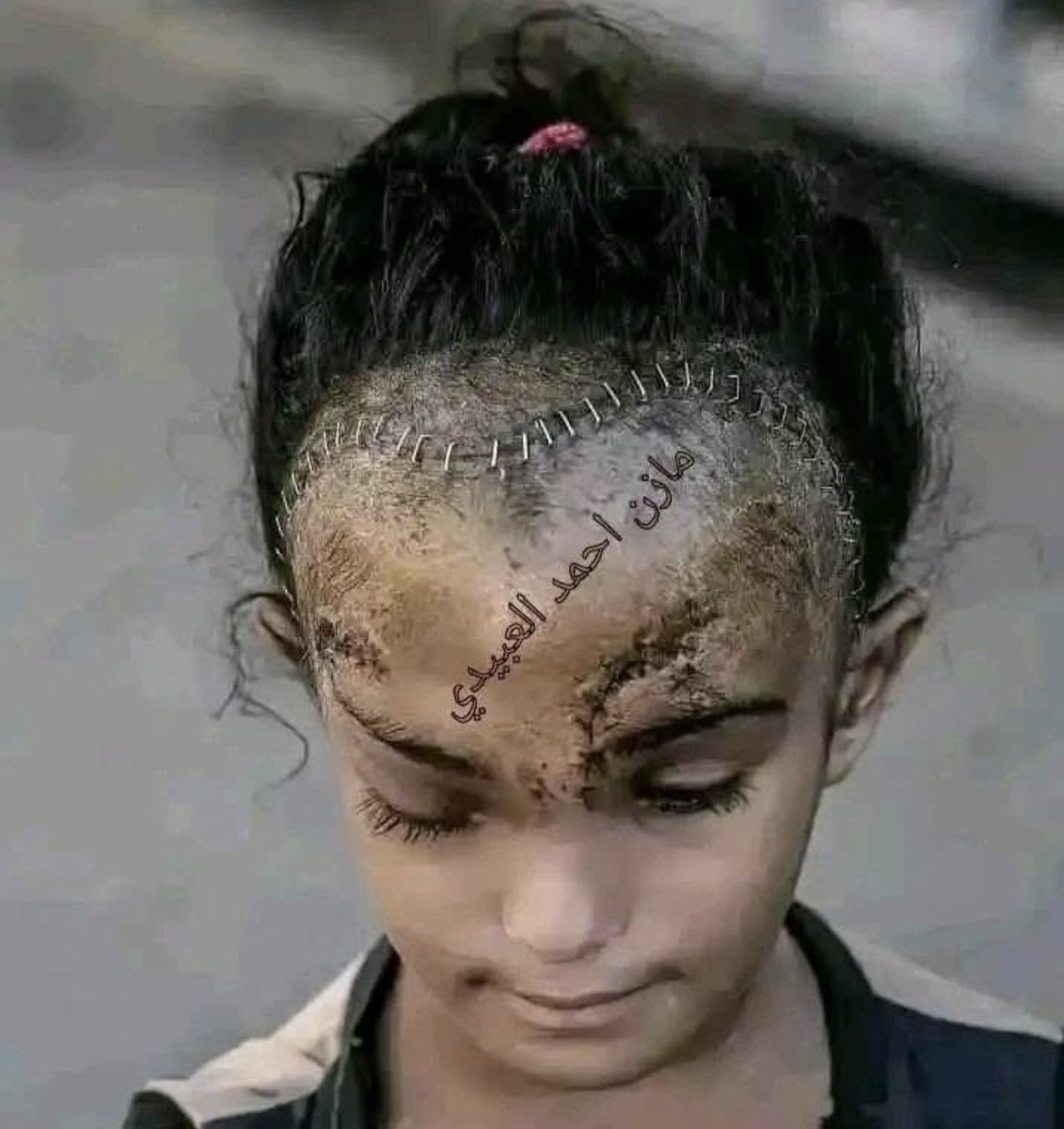 Ex_Catholique_'s tweet image. Ta douleur d’hier est ta force d’aujourd’hui et de demain‼️
#ResistToExist
👊🏽🇵🇸✌🏽