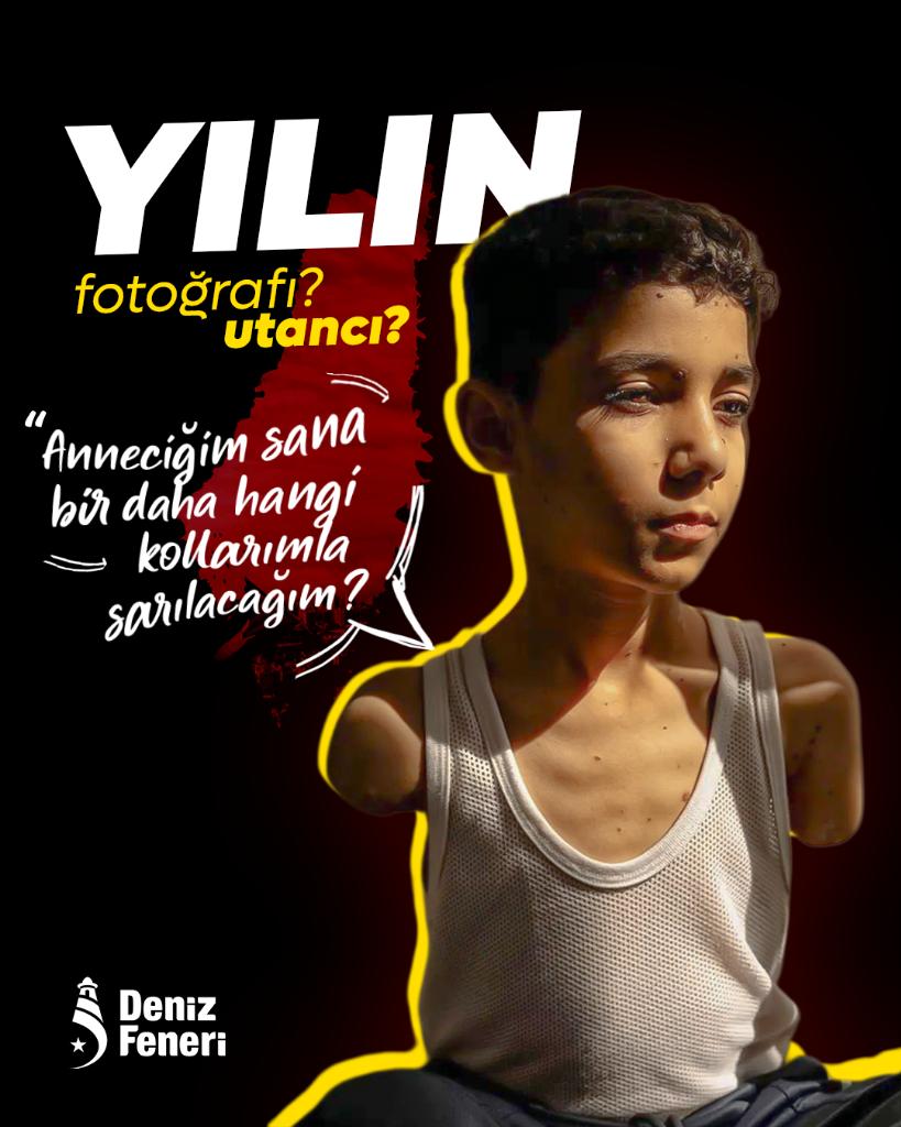 İsrail'in bombardımanı sonrası kollarını kaybeden ve "Anneciğim sana bir daha hangi kollarımla sarılacağım" diye soran çocuğun fotoğrafı, yılın fotoğrafı seçilmiş.

Yılın fotoğrafı mı, yılın utancı mı siz karar verin.