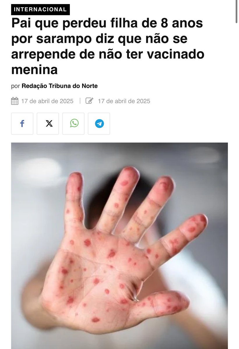 claysonfelizola's tweet photo. SP já registra primeiro caso de sarampo depois do Brasil ter sido exemplo para o mundo em eficiência na vacinação.

A praga da extrema direita é assassina, abjeta e revoltante. A extrema direita é o câncer satânico da sociedade atual. https://t.co/gJvcoX8OXY
