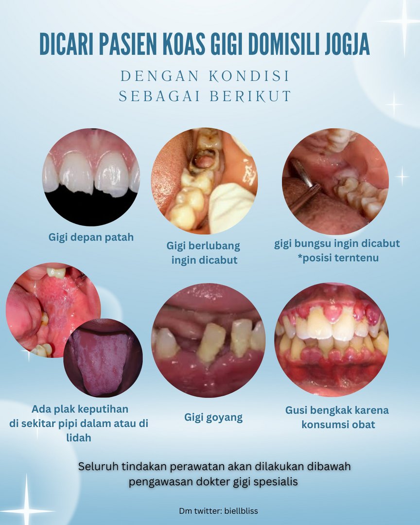 JOGJA FESS | KIRIM FESS CEK PINNED tweet media