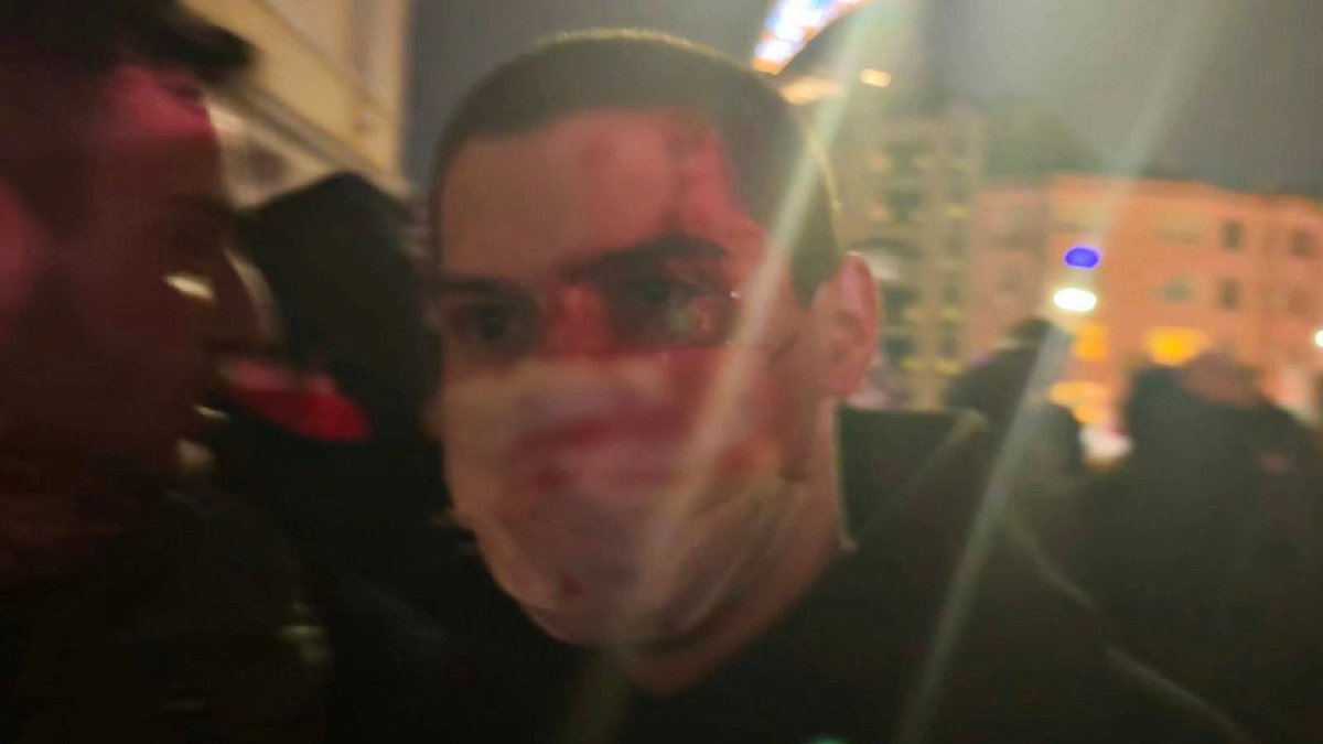 BU GÖRÜNTÜYÜ UNUTMA UNUTTURMA