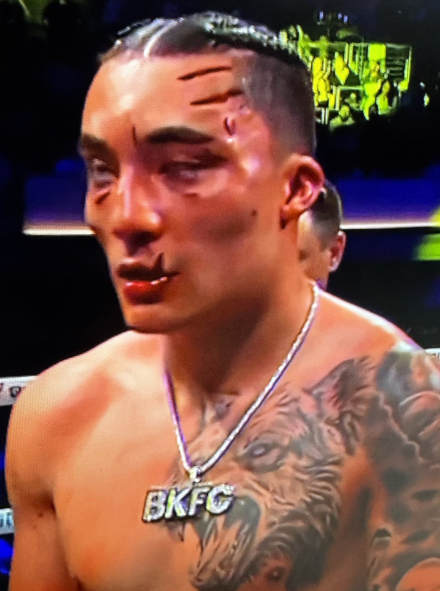 MMArena_'s tweet photo. Peut-être qu’il a combattu un tigre https://t.co/aiyVZNKyd7