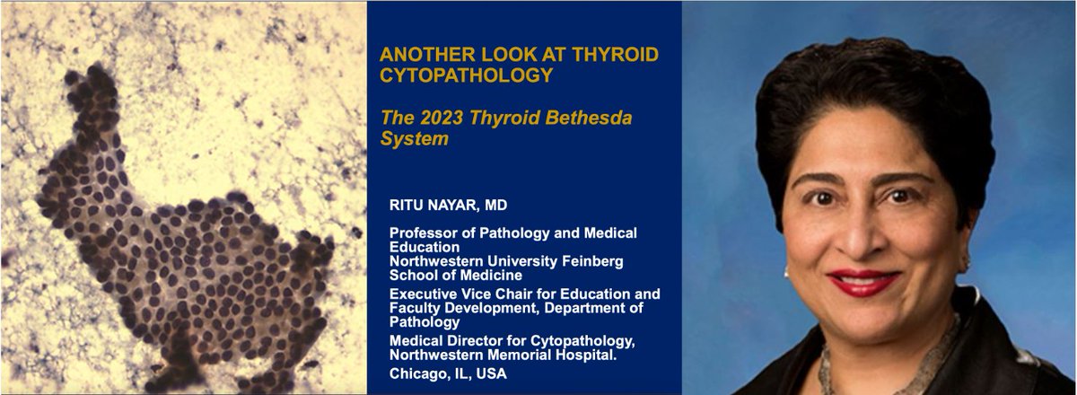 Indiana Association of Pathologists (@indianapath) on Twitter photo Wrapping up the day with <a href="/NayarRitu/">Ritu Nayar, MD</a> talking on thyroid cytopathology—sharing case-based insights on cellular patterns, diagnostic pitfalls, and tips to refine Bethesda System classification. #cytopath #pathtwitter Wrapping up the day with <a href="/NayarRitu/">Ritu Nayar, MD</a> talking on thyroid cytopathology—sharing case-based insights on cellular patterns, diagnostic pitfalls, and tips to refine Bethesda System classification. #cytopath #pathtwitter