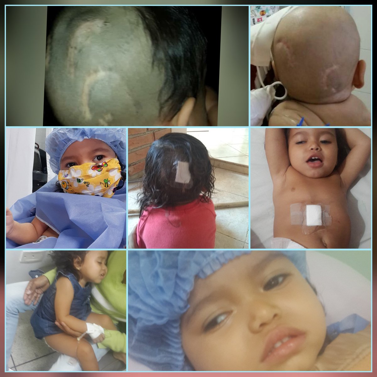 mariani87784922's tweet photo. Ruego me ayuden para mis tratamientos soy una niña con muchas ganas d vivir, tengo multiples diagnosticos entre ellos pubertad precoz fuerte faltan $120 para la amp decapeptyl.
pago m
04245649764
17659326
mercantil 

Banesco 
04245649764
ci 14171258

Zelle al dm https://t.co/QjbzPqgHve