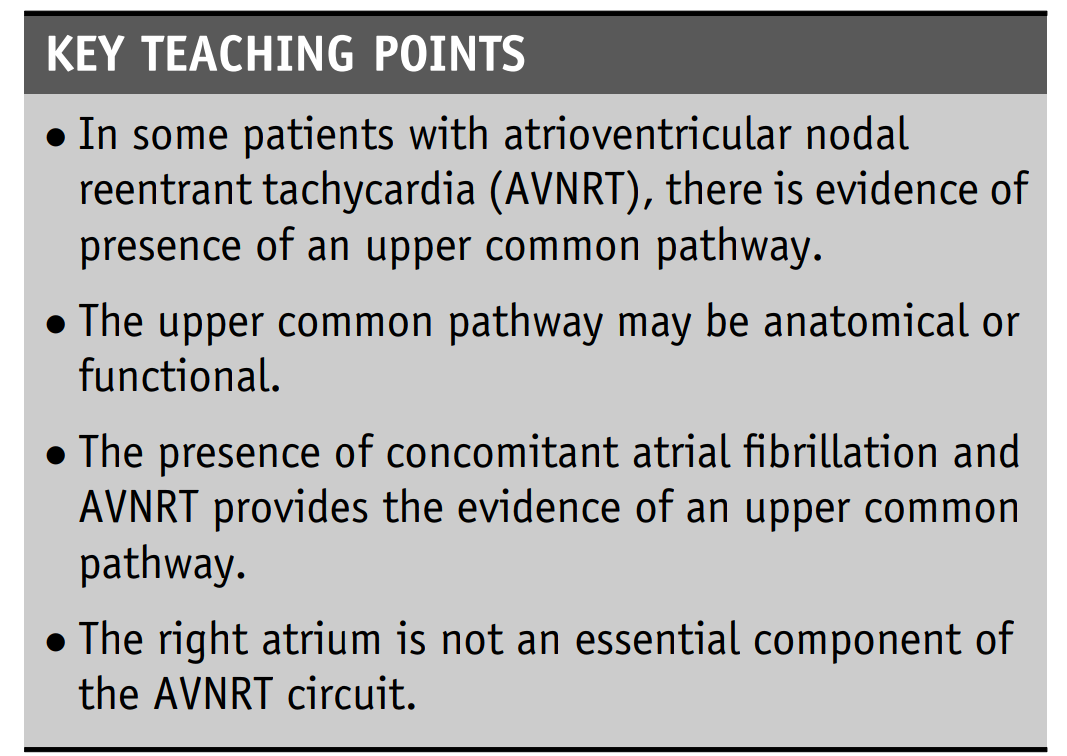 AVNRT and AV dissociation. Here's the link to a paper. (The post where I was educated is in the subthread.)
heartrhythmcasereports.com/article/S2214-…