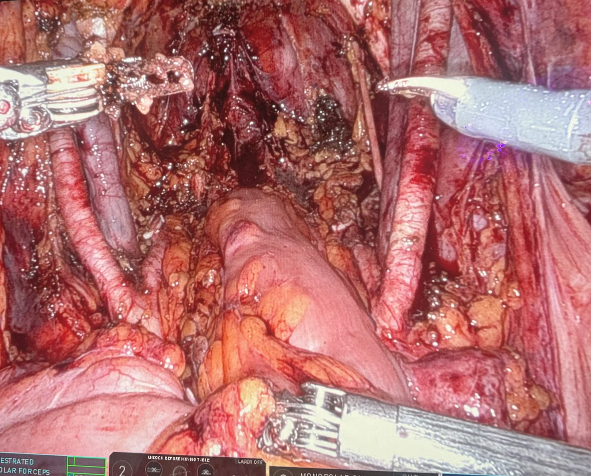 <a href="/CleveClinicFL/">Cleveland Clinic Florida</a> <a href="/CleClinicUro/">Cleveland Clinic Urology</a> <a href="/drjkaouk/">Dr. J. Kaouk</a> Contact us to find out about the opportunities to take your surgical skills to the next level!