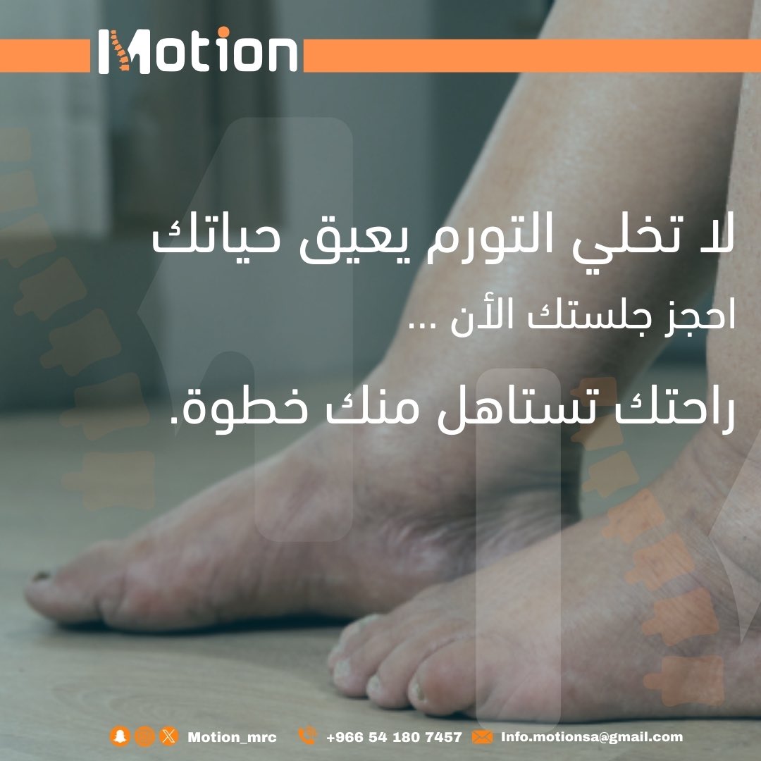 كثير يشوف التورم شيء “عادي” أو “احتباس بسيط” يروح مع الوقت🙅🏻‍♀️ 
لكنه أحيانًا يكون علامة على #الليمفوديما، اللي ممكن تأثر على حركتك وجودة حياتك🩼

موشن موجود علشان نرجّع لك يومك… خفيف ومليان حياة🧡🚀

#علاج_طبيعي #مركز_حركة #المدينة_المنورة