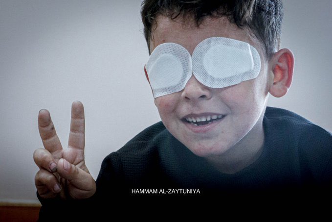 Palestinian child Ahmad Hijazi from Gaza..
He lost his sight in Israeli bombing, but did not lose his SMILE 😊