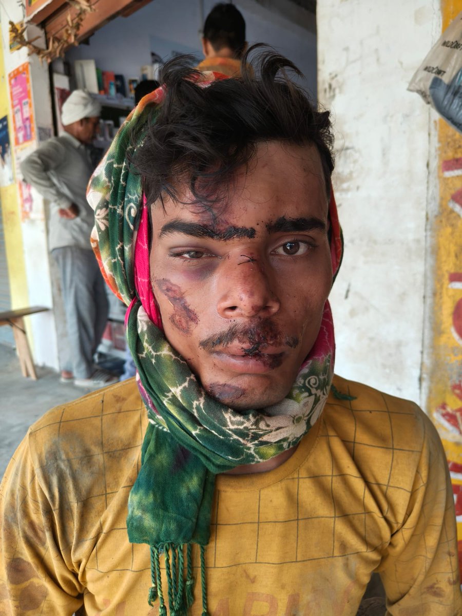 AkashKumarJat20's tweet photo. थाना नारखी के गांव गढ़ी तारा पीड़ित टीटू को कल रात्रि 7 बजे रास्ते में घेर कर की मारपीट पीड़ित हुआ बुरी तरह घायल अभी तक नहीं हुई कोई कार्यवाही आरोपी घूम रहे हैं खुलेआम महोदय संज्ञान लेकर मुकदमा दर्ज कर उचित कानून कार्रवाई करें @112UttarPradesh @firozabadpolice @Uppolice @dgpup https://t.co/IBAbRnyr9t