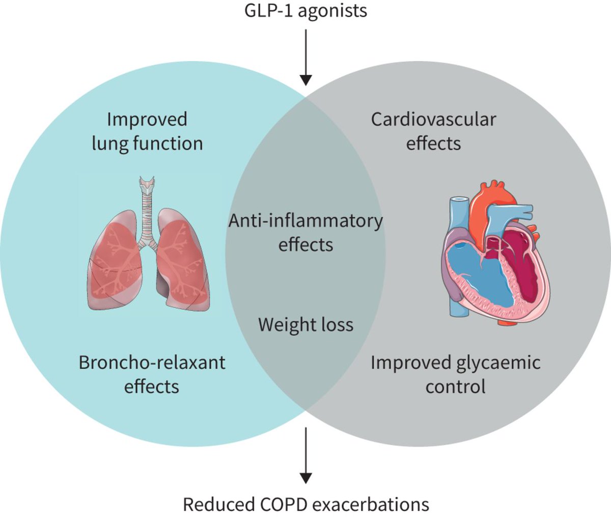 ERJ Open Res: Multimorbid severe COPD patients need to be treated with a complementary systemic approach. In this way, the patient, not only the airway disease, will be treated comprehensively, as two effects (metabolic and pulmonary) are better than one. bit.ly/3PHoygt