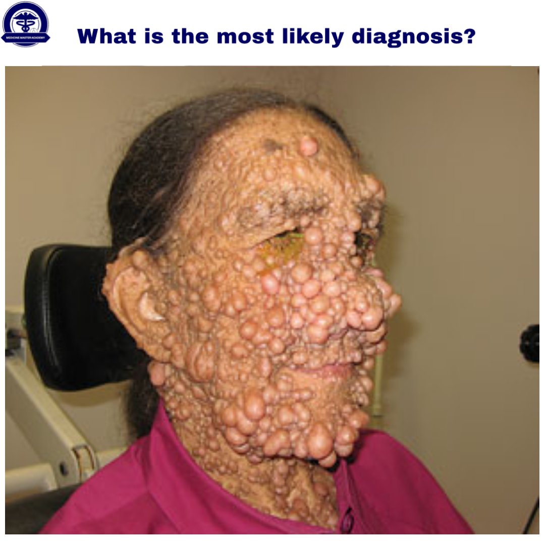 You are welcome to participate 😉

#usmle #medicine #meded #medicaleducation #UsmleSTEP1 #usmlestep2ck #neurology #genetics #dermatology #mcat #science #medical #diagnosis #medicinemasteracademy