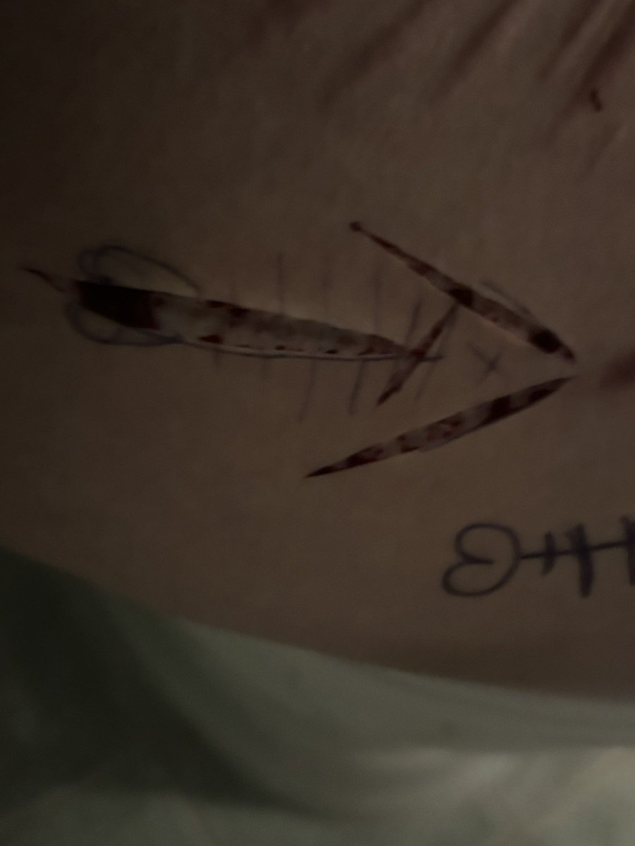cheeeesy69's tweet photo. Tried to carve out a fishbone on the side of my thigh following the guidelines. Went so BAD. Gave up midway https://t.co/mosqahBT7x