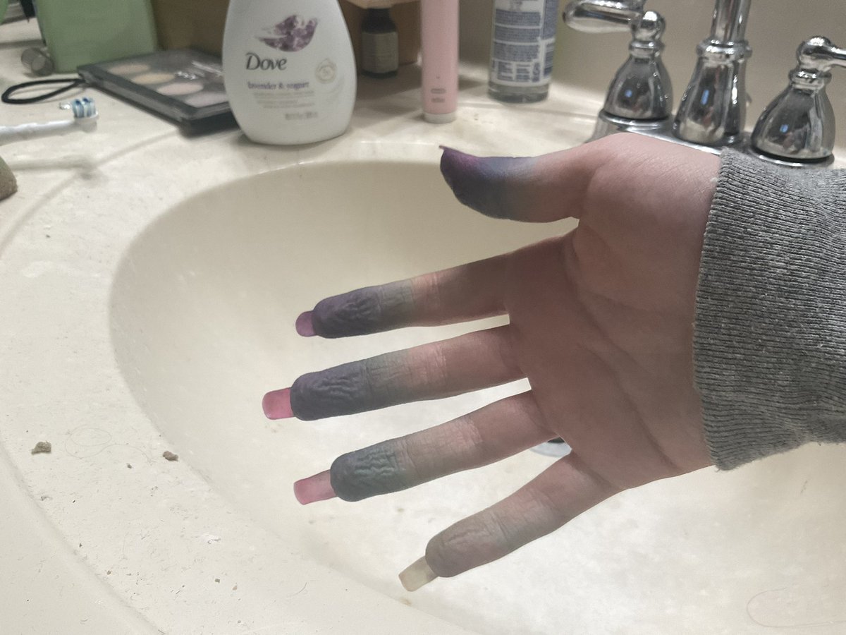 Dyed ewgs now my fingers colorful so ciool