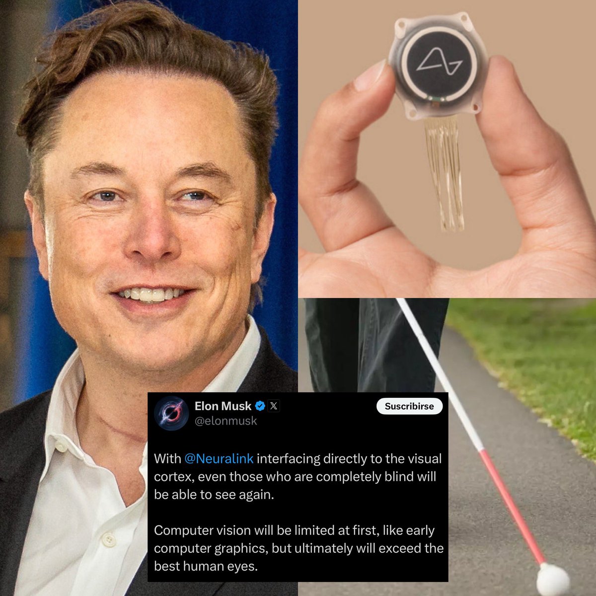 CerebrosG's tweet photo. De último momento: Palabras de Elon Musk.

“Con Neuralink conectándose directamente con la corteza visual, incluso aquellas personas completamente ciegas podrán volver a ver. La visión computarizada será limitada al principio, como los primeros gráficos por computadora, pero con el tiempo superará a los mejores ojos humanos.”