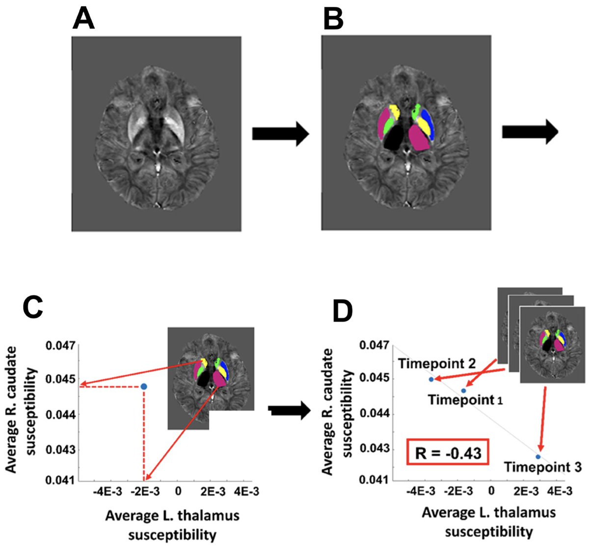 New paper in Imaging Neuroscience by Jack A. Reeves, Ferdinand Schweser, et al:

IRONMAP: Iron network mapping and analysis protocol for detecting over-time brain iron abnormalities in neurological disease

doi.org/10.1162/imag_a…