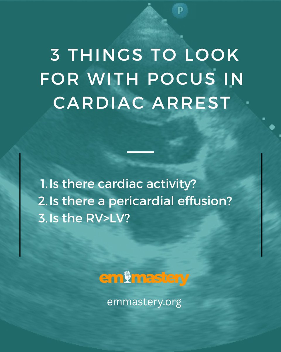 drpeterkas's tweet photo. POCUS during cardiac arrest can change everything! The Focused Echocardiographic Evaluation in Life support (FEEL) study showed that 38% of patients with asystole on ECG, and 58% of patients in PEA, had coordinated cardiac motion associated with increased survival.
#resuscitation #emergencymedicine #pocus