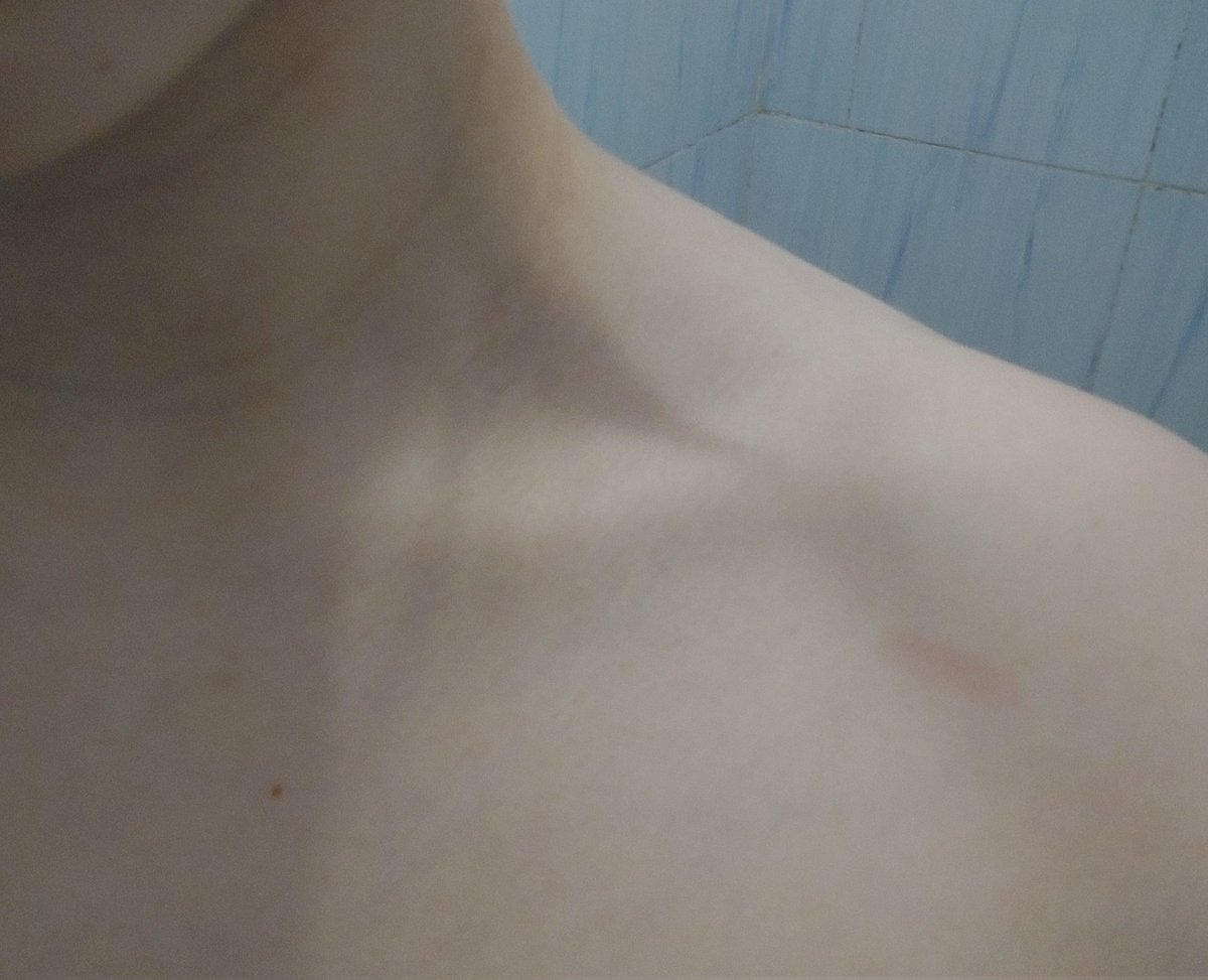 kaiasbones's tweet image. maybe its the lighting but its visible right? right????