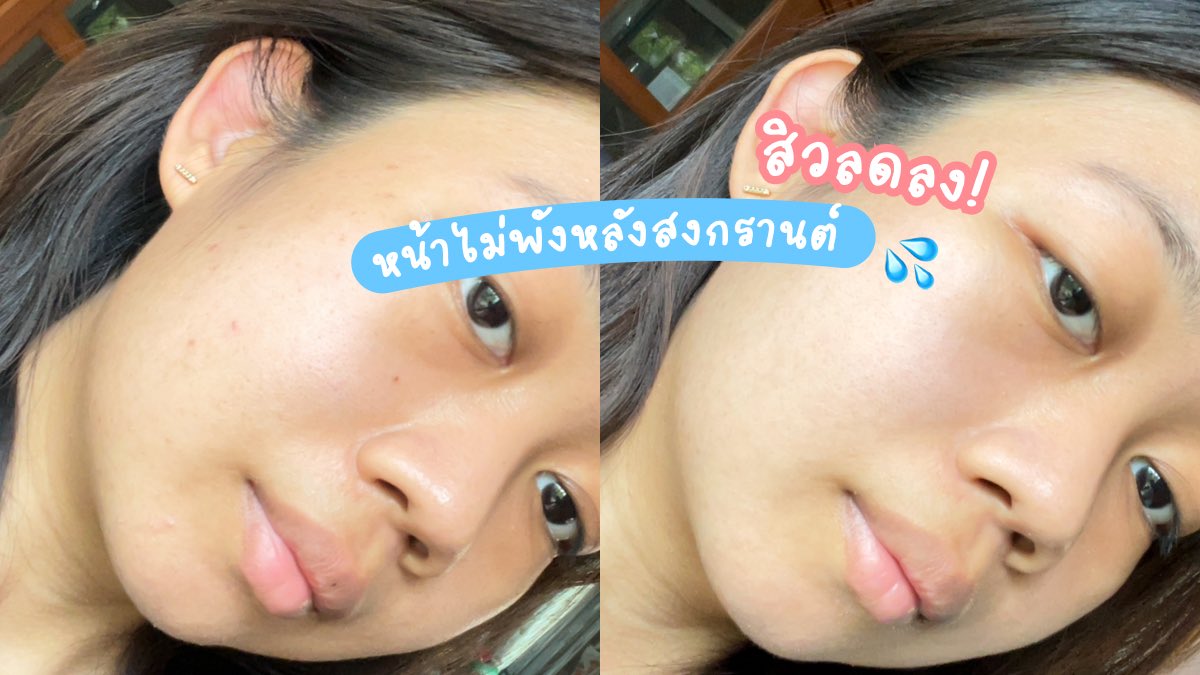 ไอเทมกู้ผิวใสหลังสงกรานต์ ปีนี้พก Jelly Me ZinC ไปด้วย 🍑 กินแล้วรู้สึกสิวลดลง เจลลี่รสพีช หอมอร่อย แช่เย็นคือฟิน~ น้ำตาล 0% ด้วยนะ เคี้ยวเพลินๆ กินได้ทุกวันแบบไม่รู้สึกผิด พิกัด 7-11

#JellyMeCuti #ความคิวทิบิลด์ง่ายได้ทุกวัน #JellyMeZinc #ลดสิว #ดีบอกต่อ https://t.co/aD4hIJsu6A