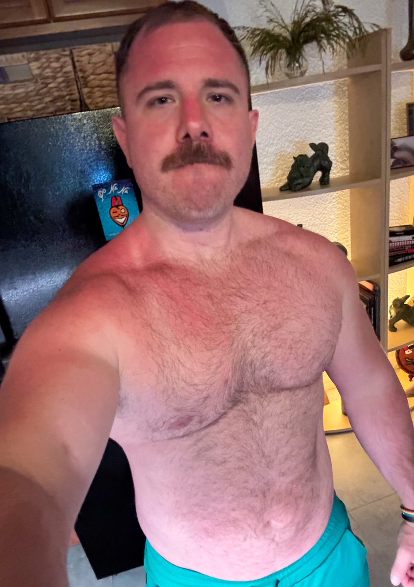 Dad got drunk and burnt at the pool party today 🥵