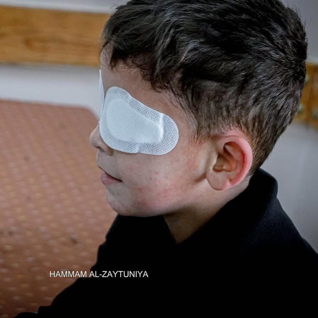 EyeonPalestine's tweet photo. The little kid Ahmed Hejazi (7) lost his sight during the war against Gaza. https://t.co/6i5PJ9Iss0