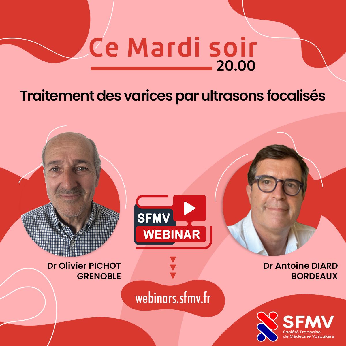 Il y a vraiment de la nouveauté du côté des varices ... Vous saurez tout ce soir à 20.00 dans le Webinar SFMV avec le Dr Olivier PIchot et le Dr Antoine DIARD qui répondront à vos questions en direct webinars.sfmv.fr