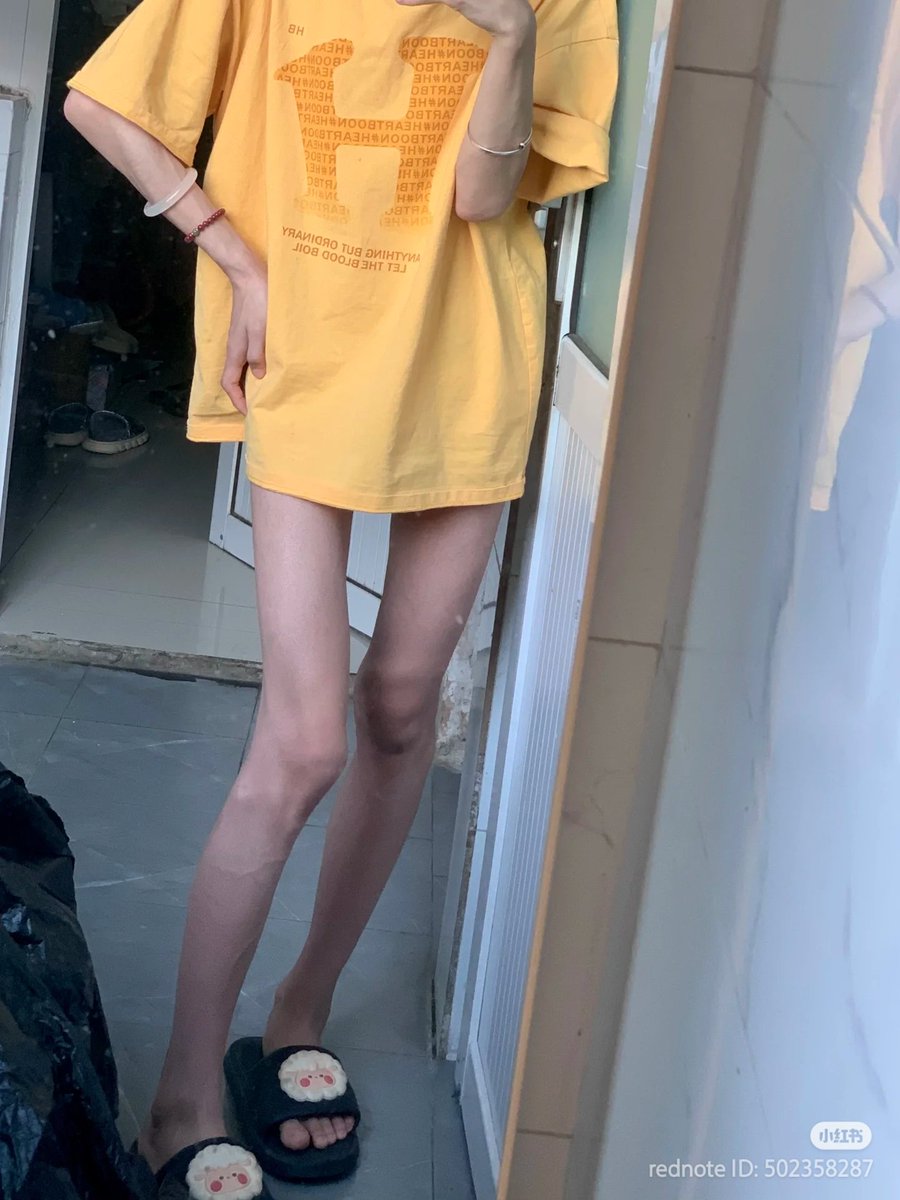 XiaosThnxspo's tweet photo. 162cm/ 37.8kg, BMI 14.4 https://t.co/plR7gzlXxF