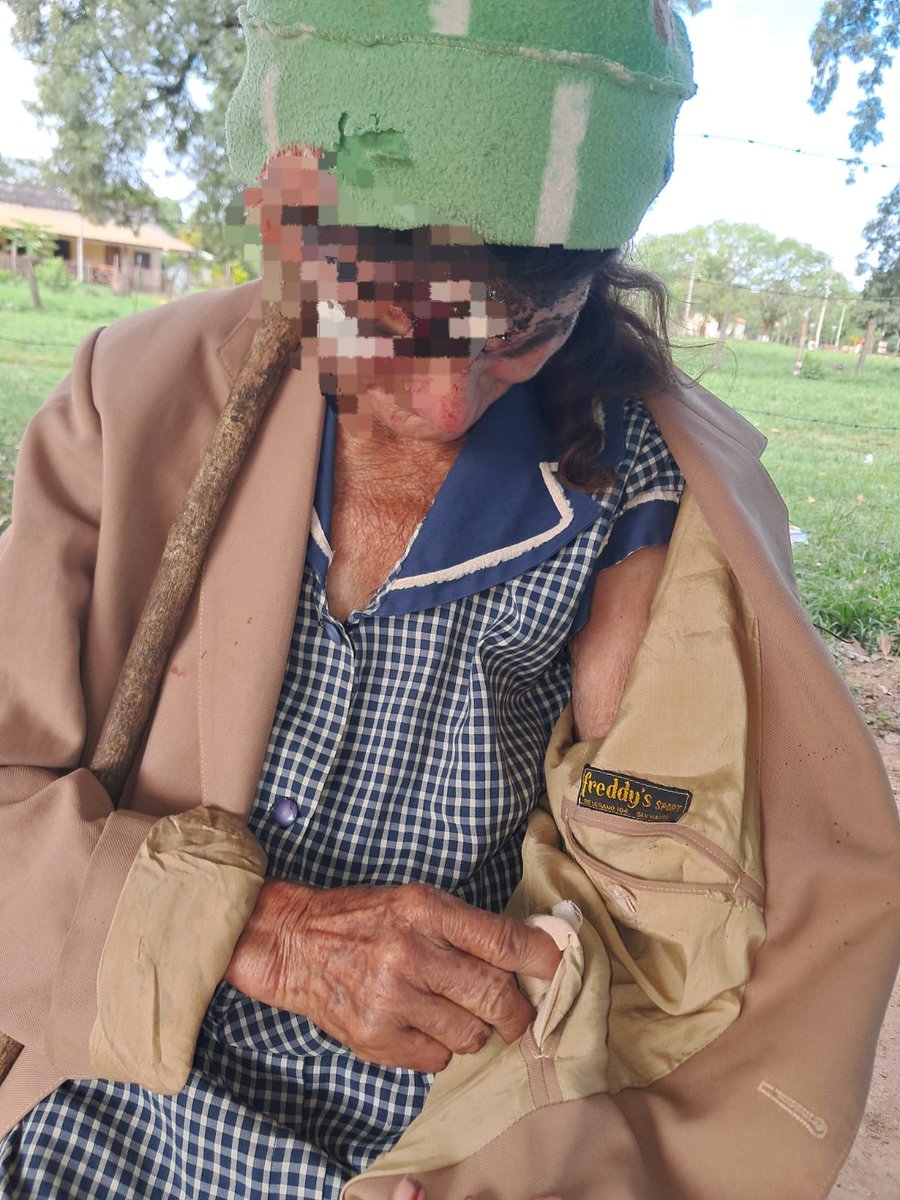 YuYu_py's tweet photo. Mujer de 70 años fue brutalmente golpeada por sus hijos en Caazapá
FULGENCIO YEGROS, CAAZAPÁ. Una mujer de 70 años fue víctima de una brutal agresión por parte de sus propios hijos en la mañana del lunes 7 de abril, en la comunidad de Puesto Naranjo, de este distrito. https://t.co/7kkswPCv0C