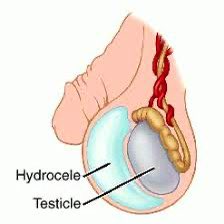 ekeyi_'s tweet photo. 🚨If your balls are swollen like a water balloon, read this.

A thread your balls will thank you for. Repost and bookmark for refrence 

Open thread🧵 https://t.co/cJAroZXk78