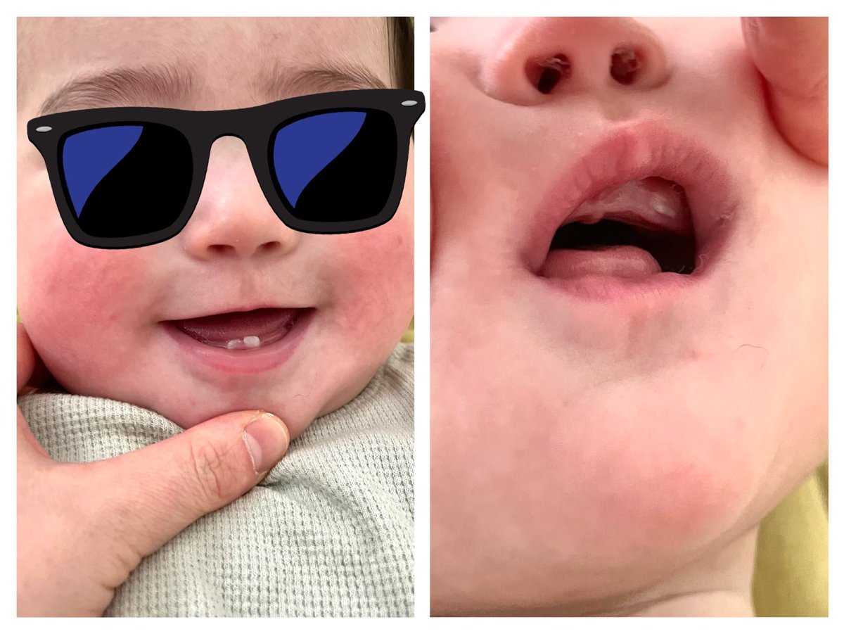 ボク、歯が生えてきた🦷
噛まれたらまじ痛い。。笑