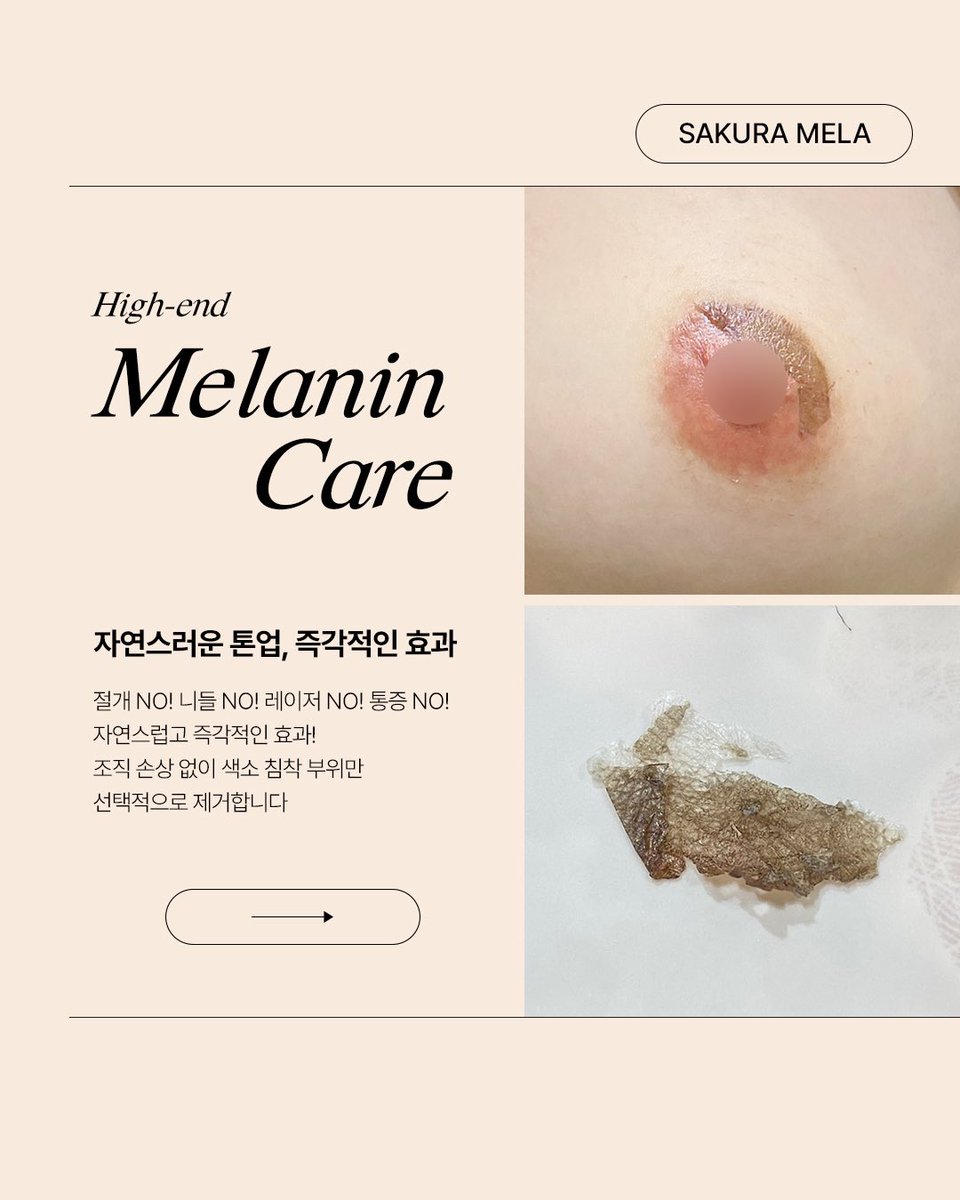 アフタークリーム　乳輪 SAKURA MELAで手軽に始める乳輪美白ケア 🌸 現在、先着で割引