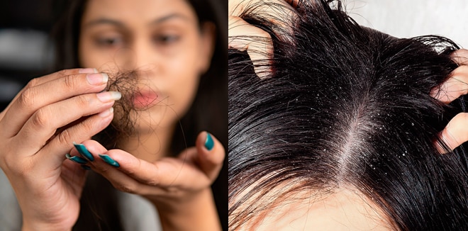 VanithaMag's tweet photo. #GlamUp #BeautyTips പൊളിഞ്ഞിളകിയ താരനും ചൊറിച്ചിലും പ്രശ്നമാകുന്നുണ്ടോ? താരൻ അകറ്റാൻ മൂന്നു എണ്ണകള്‍ https://t.co/Gg5tTA9ZKR https://t.co/M00CAjXOnc
