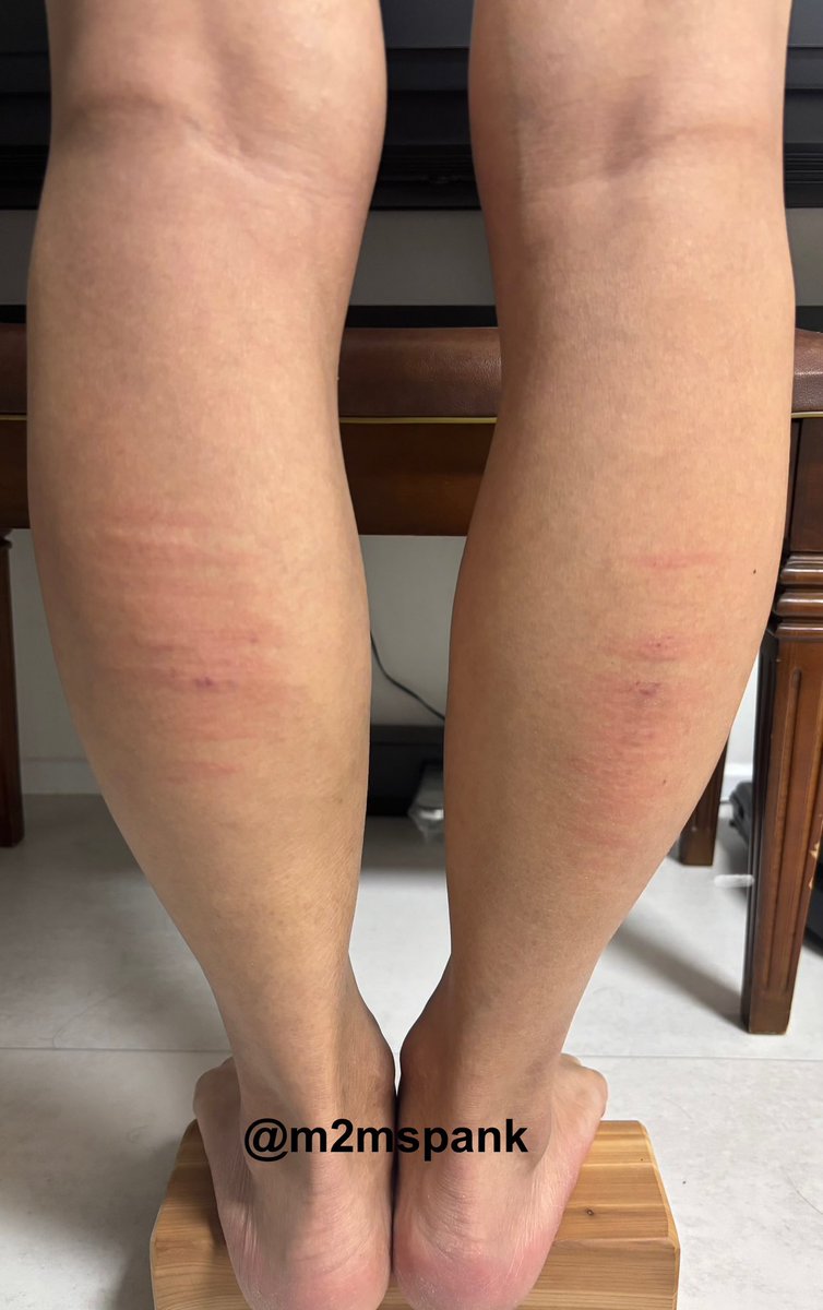 #종아리체벌 #회초리 #케인 #멜투멜