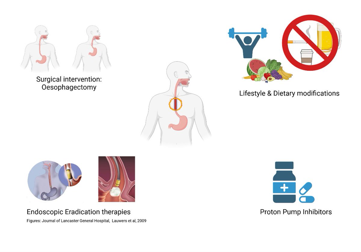 All Ireland Cancer Network (AllCaN) Oesophageal (@allcan_bcr) on Twitter photo What are current teatment options for Barrett’s Oesophagus on the Island of Ireland? 🤔 AllCaN Oesophageal PhD candidate Ms. Lorraine Smith (<a href="/Lorrainesmith_1/">Lorraine Smith</a>) reviews this in her new blog.
allcan.ie/treatmentoptio… What are current teatment options for Barrett’s Oesophagus on the Island of Ireland? 🤔 AllCaN Oesophageal PhD candidate Ms. Lorraine Smith (<a href="/Lorrainesmith_1/">Lorraine Smith</a>) reviews this in her new blog.
allcan.ie/treatmentoptio…