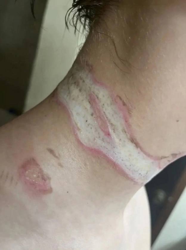 IhabFathiSulima's tweet photo. An incident occurred in the States: sixteen-year-old Reis Ogdal, having left his smartphone charging on his bed, fell asleep. During his sleep, while moving, he accidentally touched the charger's wire with a chain, which resulted in an electric shock. Fortunately, the young man survived. 

In order to prevent accidents, it is recommended to refrain from using chargers not only in damp rooms, such as the bathroom, but also in the bedroom, in particular, directly in the bed.