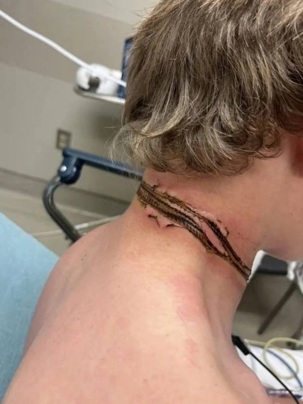 An incident occurred in the States: sixteen-year-old Reis Ogdal, having left his smartphone charging on his bed, fell asleep. During his sleep, while moving, he accidentally touched the charger's wire with a chain, which resulted in an electric shock. Fortunately, the young man