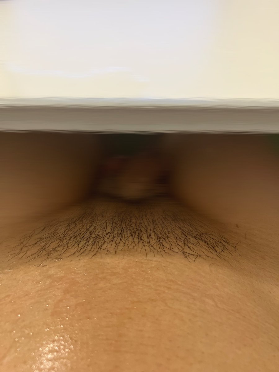 atom0407t's tweet photo. 何があるかわからないもんね‼️

キレイに整えてみた😳 https://t.co/eJSvlnq4WB