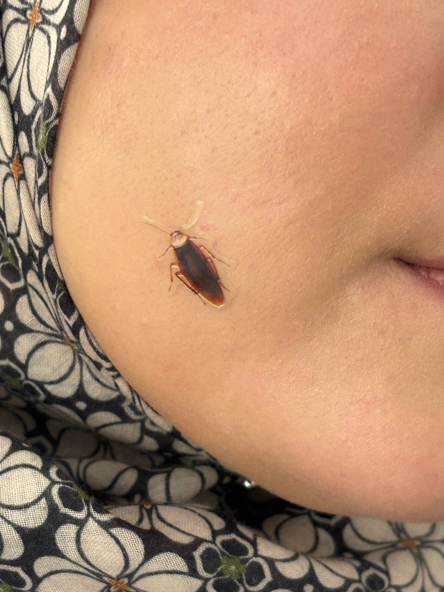 hannabunnyb's tweet photo. Dododots buat acne patch lipas, tapi I nasihatkan kalau pakai hati hati la risau kena lempang dengan orang sekeliling 🤲🏻 https://t.co/HTYWgGgMyy